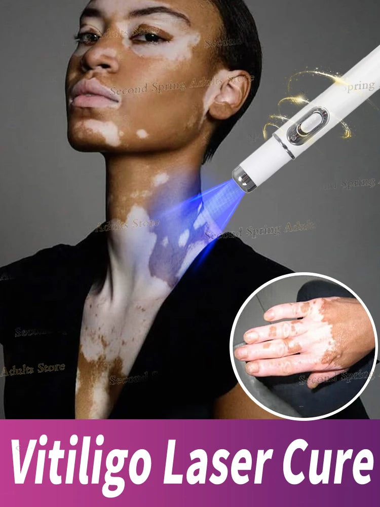 Herbal Extract Vitiligo Ointment Remove Ringworm White Spot Removal Skin Vitiligo Eliminate Vitiligo Treatment Cream