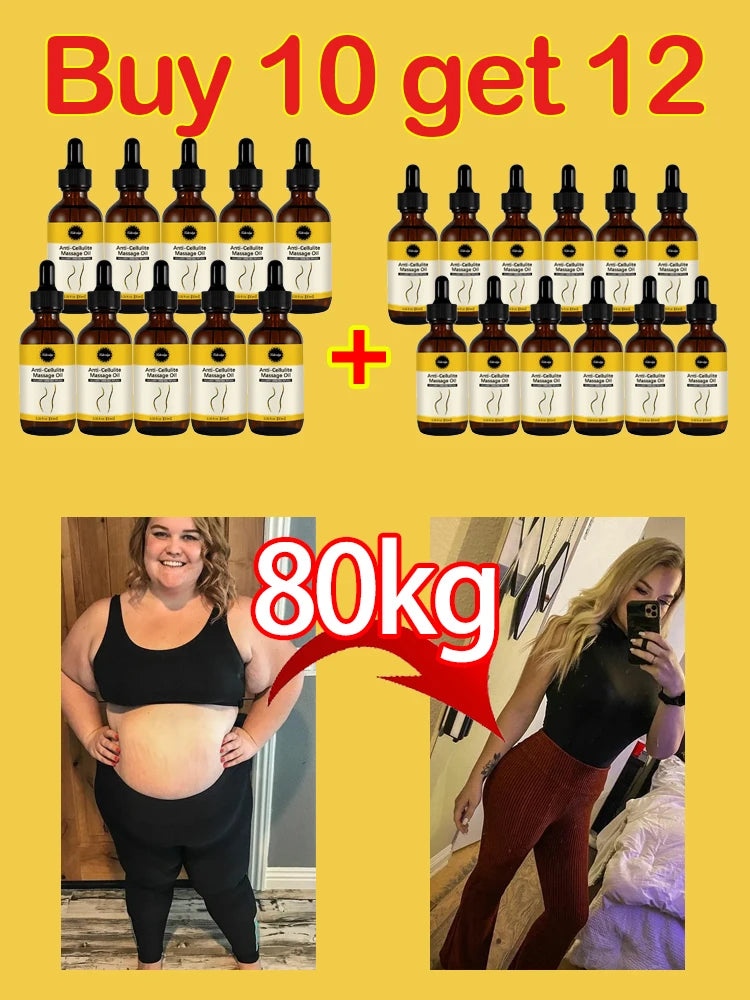 Slimming Essential Oils Navel Burn Fat Weight Loss Waist Belly Anti Cellulite Weight Loss Products Effective Fat Burning